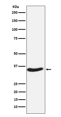 Anti-RRP42 Rabbit Monoclonal Antibody