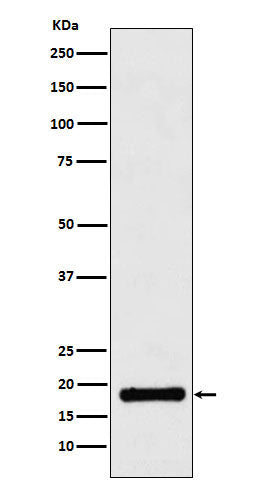 Anti-Ubiquitin Conjugating Enzyme E2 A/B Rabbit Monoclonal Antibody