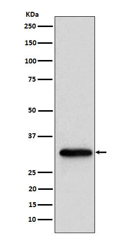 Anti-NUDT5 Rabbit Monoclonal Antibody