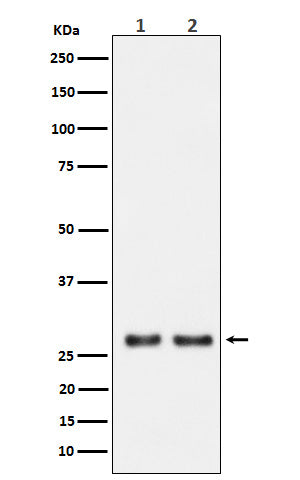Anti-Uridine Phosphorylase 1 Rabbit Monoclonal Antibody