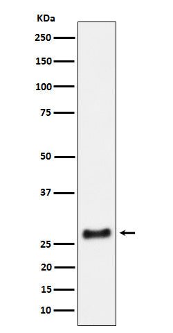 Anti-SNRPA1 Rabbit Monoclonal Antibody
