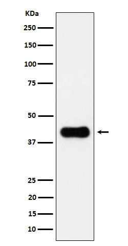 Anti-ACAA2 Rabbit Monoclonal Antibody