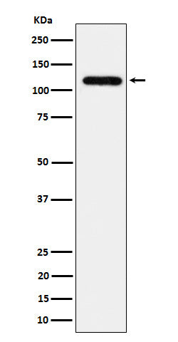 Anti-UBE4A Rabbit Monoclonal Antibody