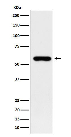 Anti-Sulfite oxidase Rabbit Monoclonal Antibody