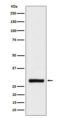 Anti-BRMS1 Rabbit Monoclonal Antibody