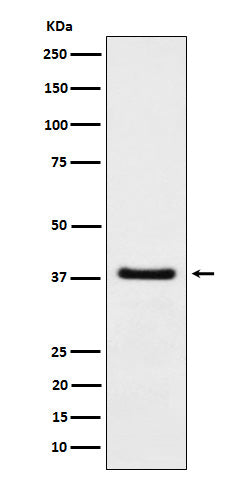 Anti-HDGF Rabbit Monoclonal Antibody
