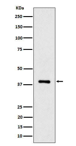 Anti-ACAT2 Rabbit Monoclonal Antibody