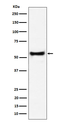 Anti-PDCD7 Rabbit Monoclonal Antibody