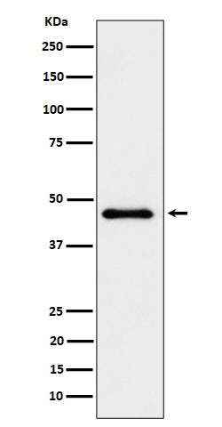 Anti-ELP4 Rabbit Monoclonal Antibody