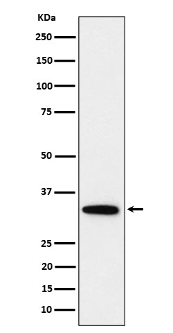 Anti-PPP6C Rabbit Monoclonal Antibody