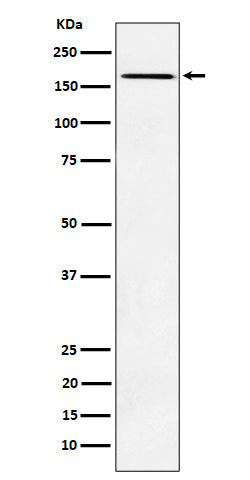 Anti-AGL Rabbit Monoclonal Antibody