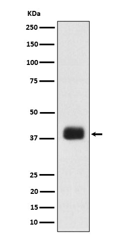 Anti-SR protein repeat Rabbit Monoclonal Antibody