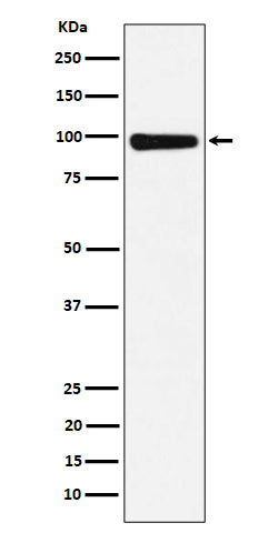 Anti-CHM Rabbit Monoclonal Antibody