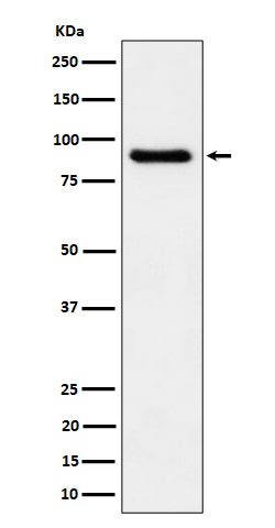 Anti-C1s Rabbit Monoclonal Antibody