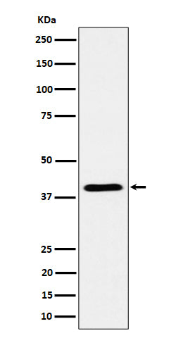 Anti-ADH4 Rabbit Monoclonal Antibody