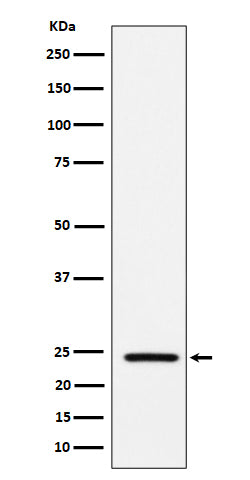 Anti-Acetyl-SOD2 (Lys68) Rabbit Monoclonal Antibody