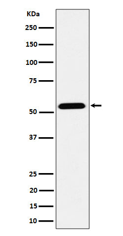 Anti-ENPP5 Rabbit Monoclonal Antibody
