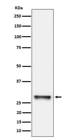 Anti-PNMT Rabbit Monoclonal Antibody