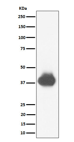 Anti-CD32A+CD32B+CD32C Rabbit Monoclonal Antibody