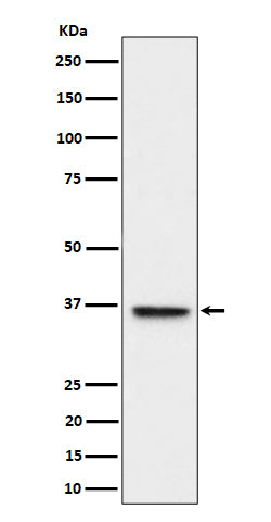 Anti-ULBP1 Rabbit Monoclonal Antibody