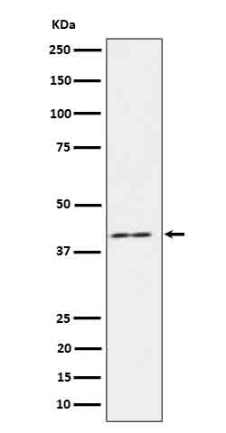 Anti-IL-18BP Rabbit Monoclonal Antibody