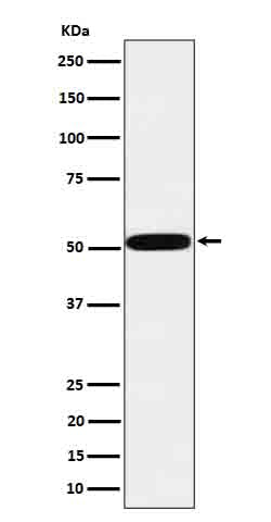 Anti-HTRA1  Rabbit Monoclonal Antibody