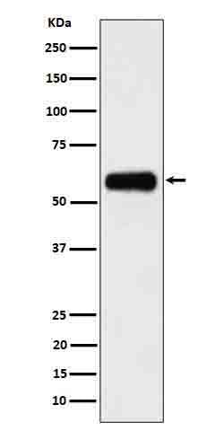 Anti-CSF2RA Rabbit Monoclonal Antibody
