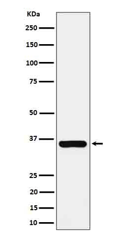 Anti-GGH Rabbit Monoclonal Antibody