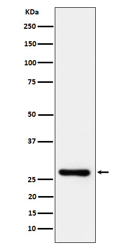 Anti-DcR1/CD263 Rabbit Monoclonal Antibody