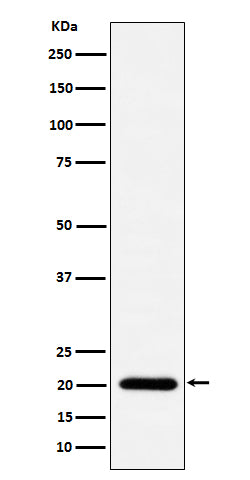 Anti-TIMM22 Rabbit Monoclonal Antibody