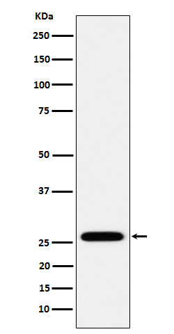 Anti-HoxC6 Rabbit Monoclonal Antibody
