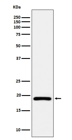 Anti-DUTPase Rabbit Monoclonal Antibody