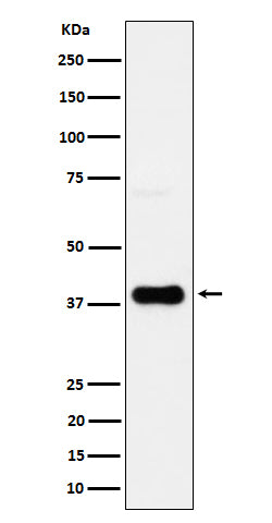 Anti-CXCR6 Rabbit Monoclonal Antibody