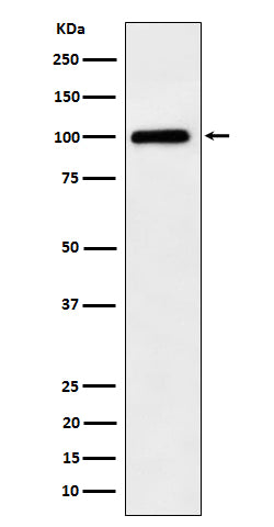 Anti-Desmocollin 1 Rabbit Monoclonal Antibody