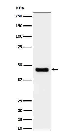 Anti-CABP Rabbit Monoclonal Antibody