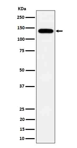 Anti-Tripeptidyl peptidase II Rabbit Monoclonal Antibody