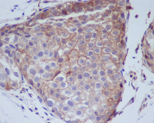 Anti-Phospho-EGFR (Tyr1068) Rabbit Monoclonal Antibody