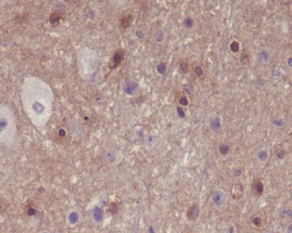 Anti-Phospho-PAK1/2/3 (Ser144/Ser141/Ser139) Rabbit Monoclonal Antibody