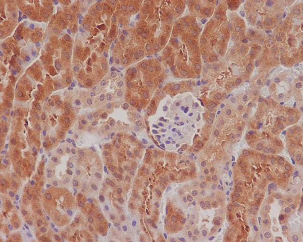Anti-Phospho-eIF4E (Ser209)  Rabbit Monoclonal Antibody