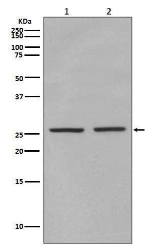 Anti-Phospho-eIF4E (Ser209)  Rabbit Monoclonal Antibody