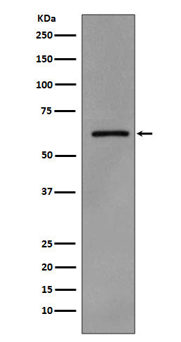 Anti-Phospho-Src (Tyr419) Rabbit Monoclonal Antibody