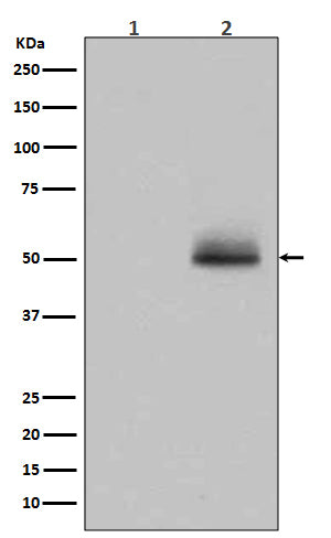 Anti-Phospho-GSK3 (alpha + beta)(Tyr216/Tyr279) Rabbit Monoclonal Antibody