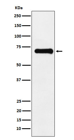 Anti-Phospho-PAK4/5/6 (Ser474/Ser560/Ser602) Rabbit Monoclonal Antibody
