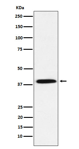 Anti-Phospho-IKB alpha (Ser36) Rabbit Monoclonal Antibody