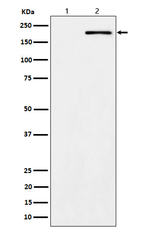 Anti-Phospho-ErbB2 (Tyr1139) Rabbit Monoclonal Antibody