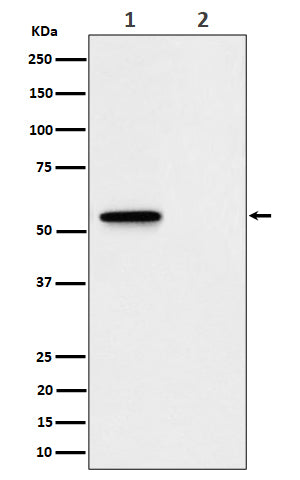 Anti-Phospho-MLKL (Ser345) Rabbit Monoclonal Antibody