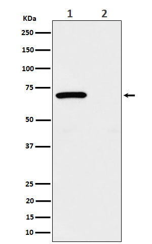 Anti-Phospho-Chk2 (Thr68) Rabbit Monoclonal Antibody