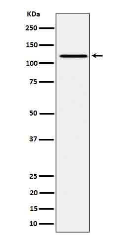 Anti-Phospho-JAK1 (Tyr1034/Tyr1035) Rabbit Monoclonal Antibody