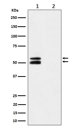 Anti-Phospho-CaMKII(Thr286) Rabbit Monoclonal Antibody