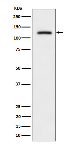 Anti-Phospho-ULK1 (Ser556) Rabbit Monoclonal Antibody